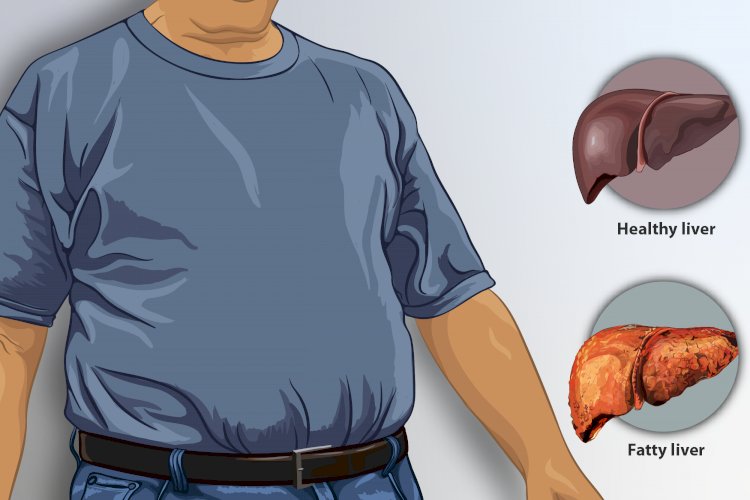 4. Healthy Liver